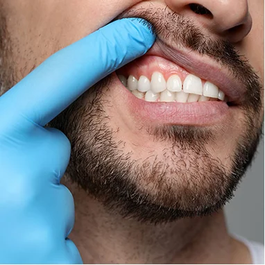 Periodontics img