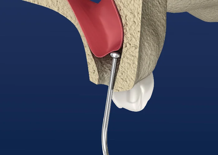 Sinus-Img aaid-member