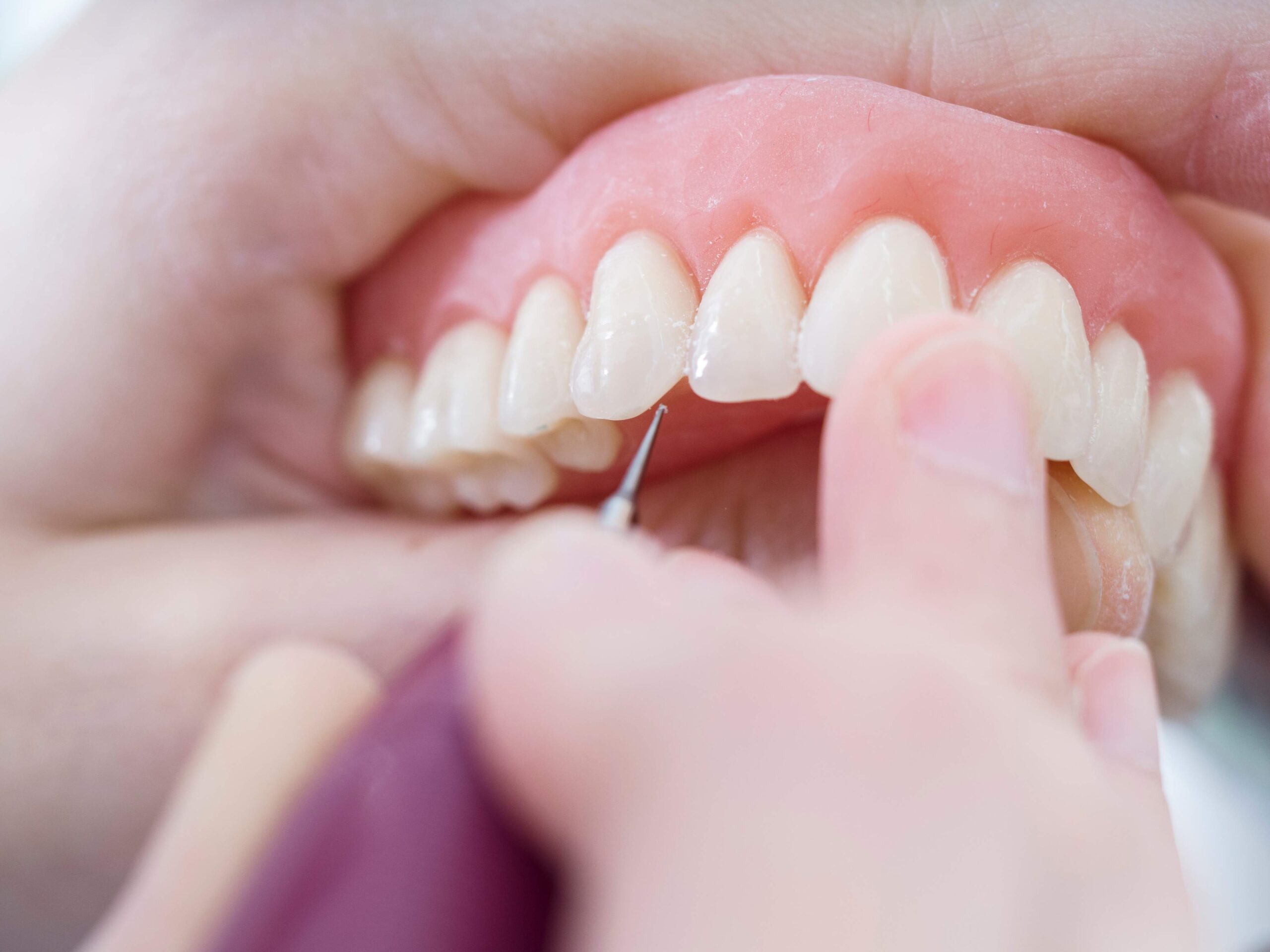 Invisalign treatment specialists in Brooklyn, NY