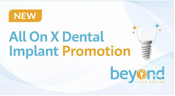 all on x dental implant promotion in Brooklyn New York